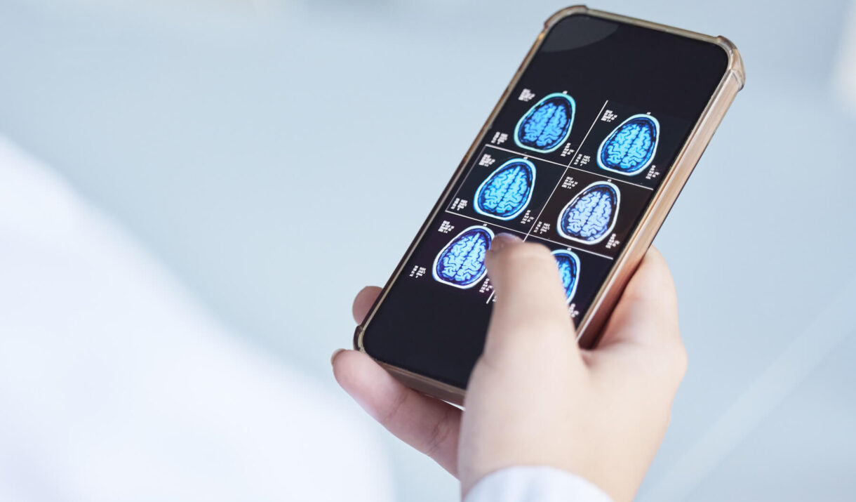 brain x ray clinic phone results and doctor hands 2023 11 27 05 09 23 utc 1 1