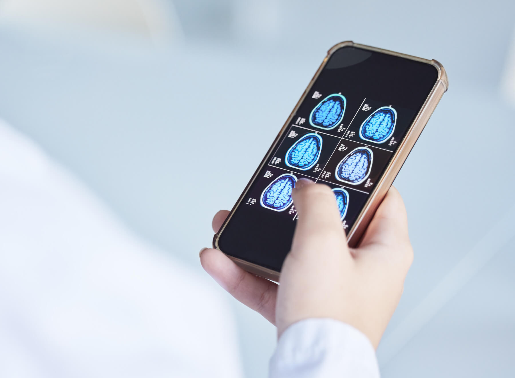 brain x ray clinic phone results and doctor hands 2023 11 27 05 09 23 utc 1 1